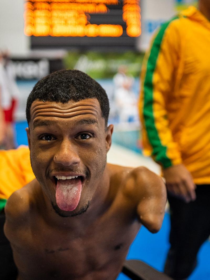 An armless man putting his tongue out of his mouth in celebration next to a swimming pool