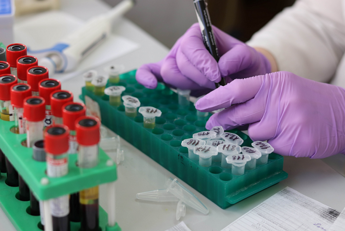 The image of a hand of person manipulating samples in a laboratory