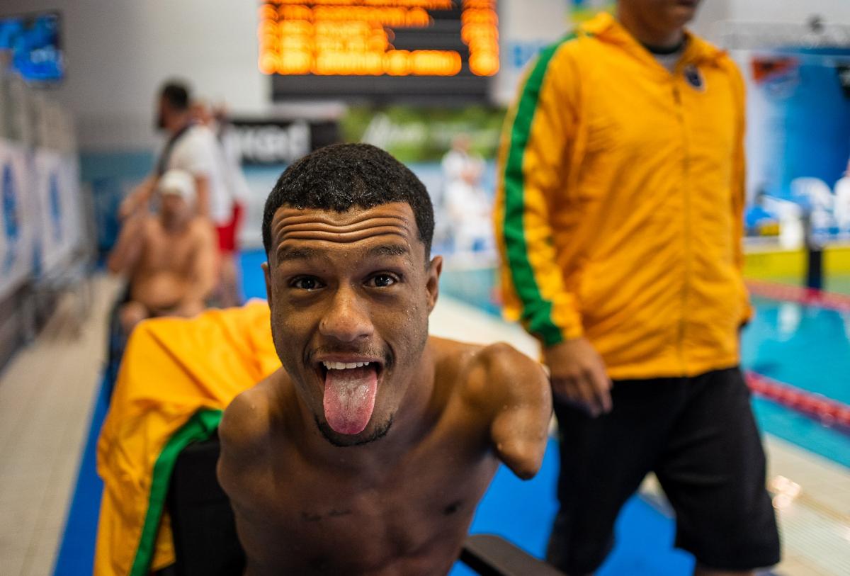 An armless man putting his tongue out of his mouth in celebration next to a swimming pool